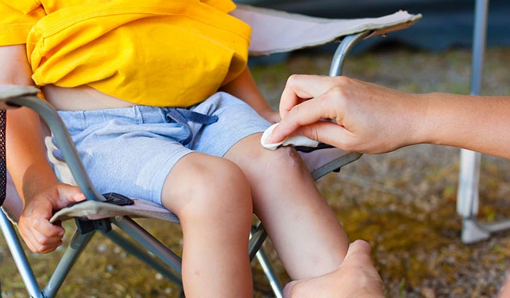 Cuts and scrapes treatment guidance savlon
