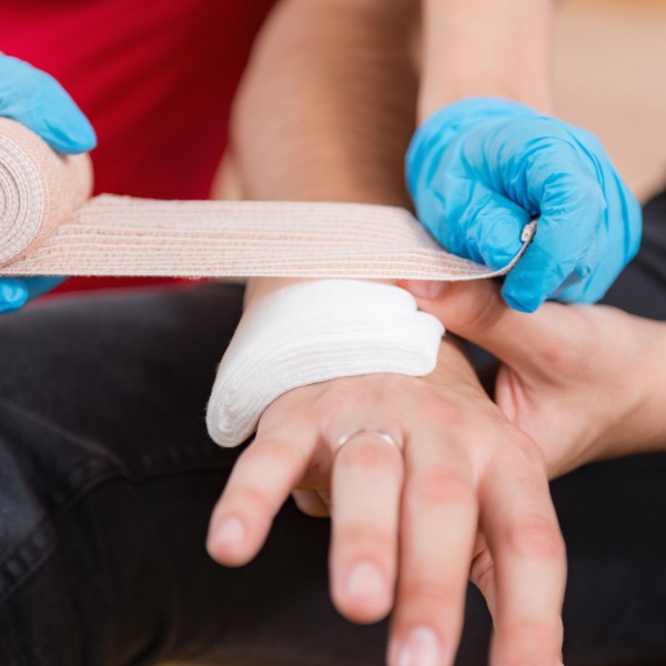 application of plaster on top of injured hand